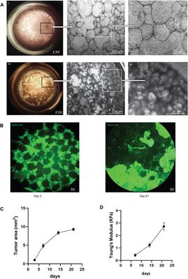 Development of a small cell lung cancer organoid model to study cellular interactions and survival after chemotherapy